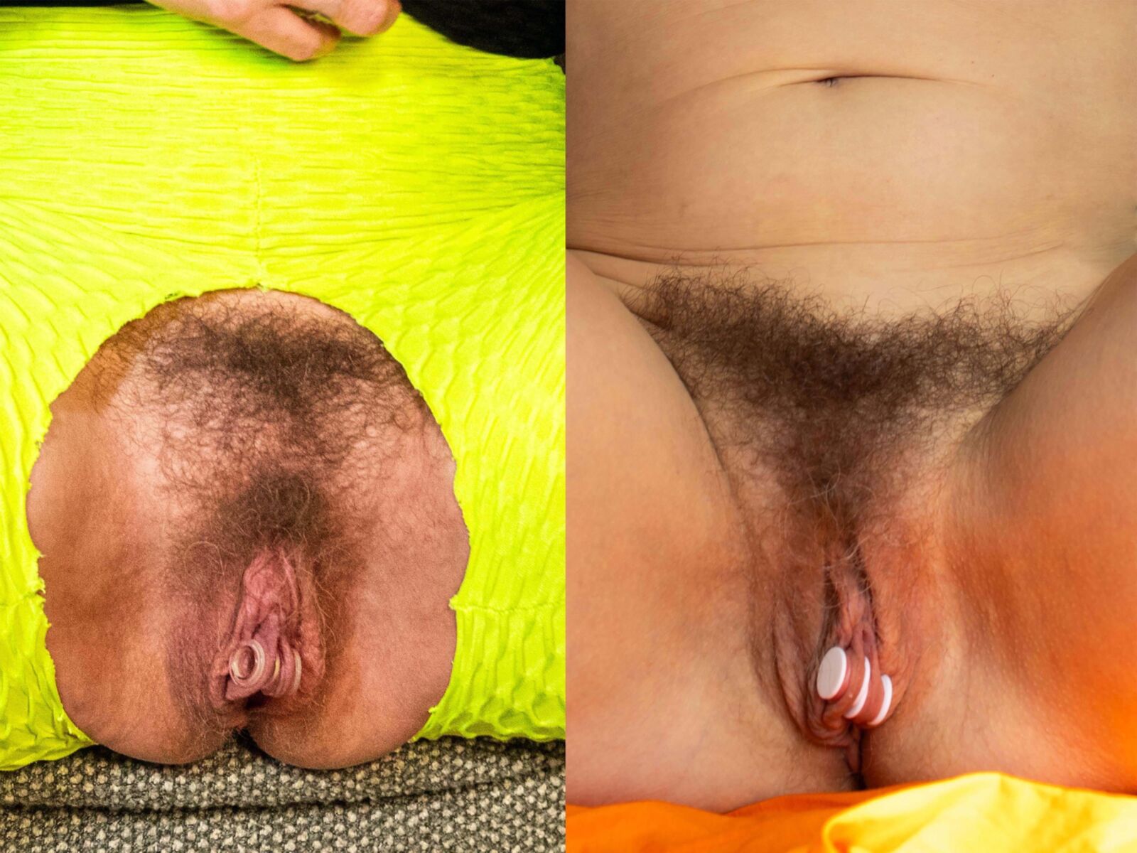 yo my clit enlargement comparison pics weeks in