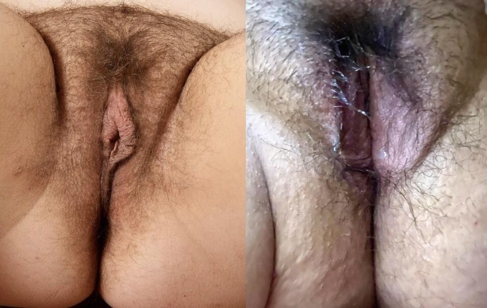 Ada vs Anna