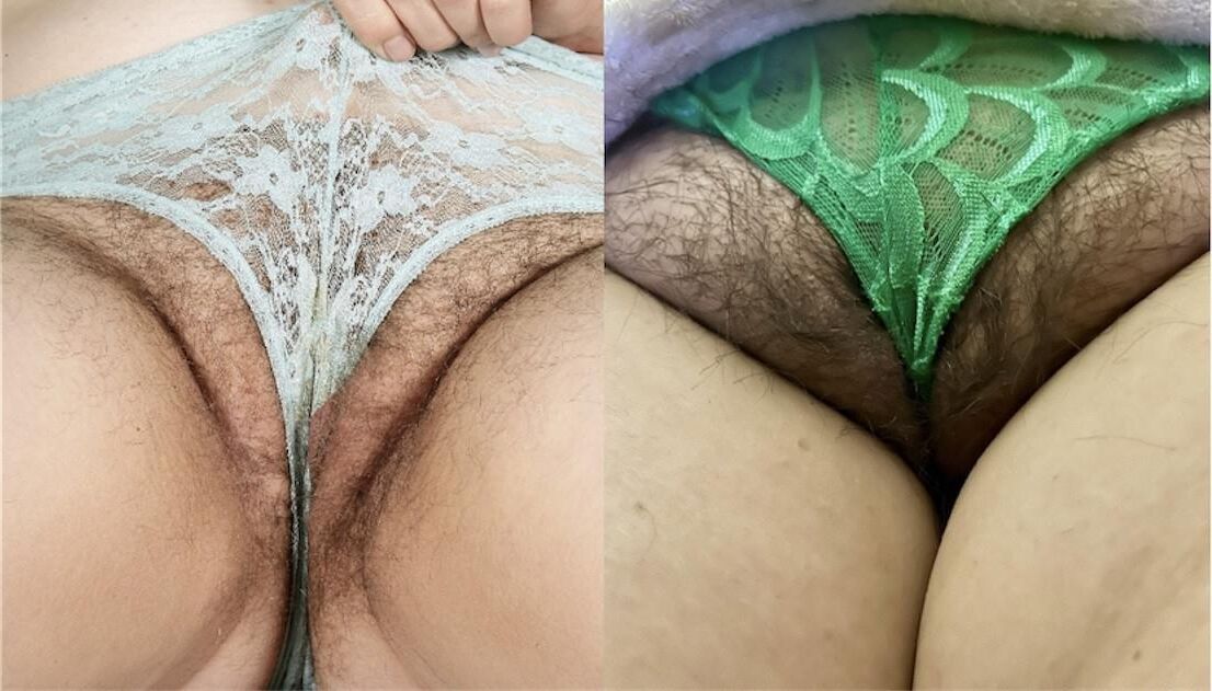 Ada vs Anna