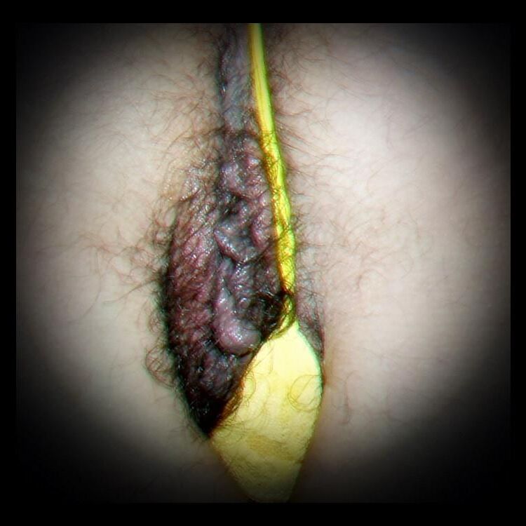 Frauen Vagina behaarte Scheide
