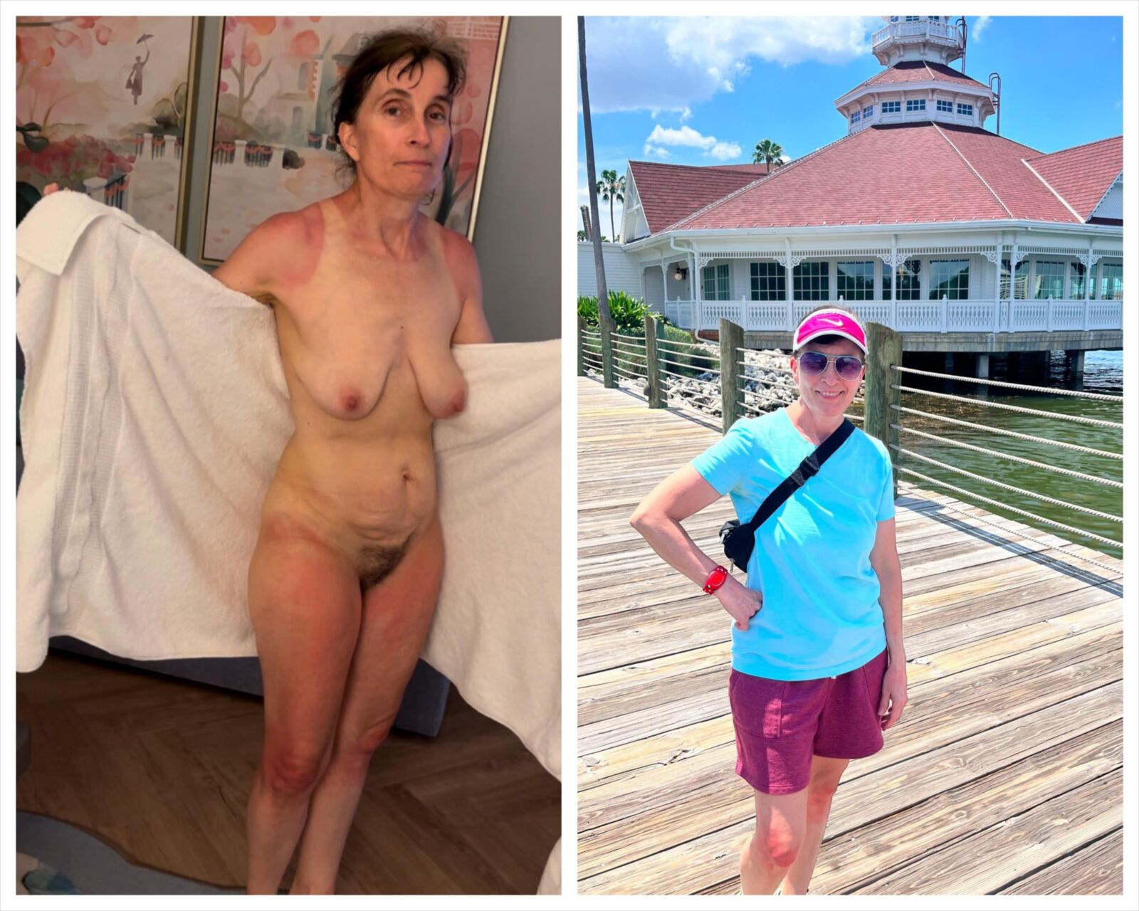 Matures and Grannies: Hairy Full Frontal 